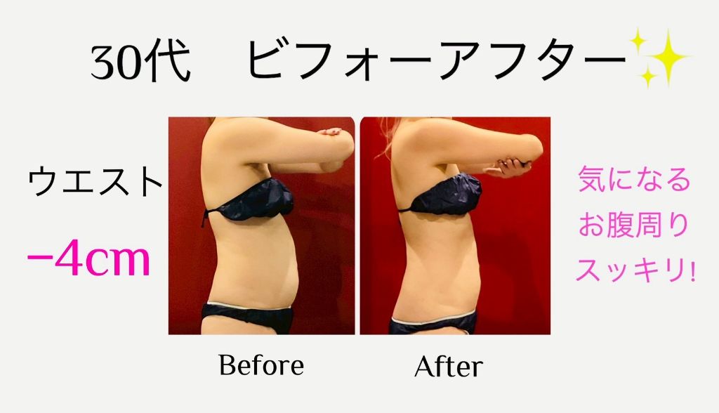 30代 ウエスト-4cm ビフォーアフター