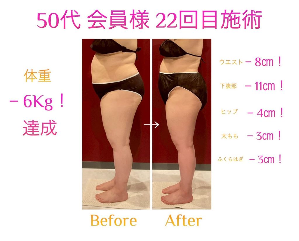 50代 体重-6kg ウエスト-8cm ビフォーアフター