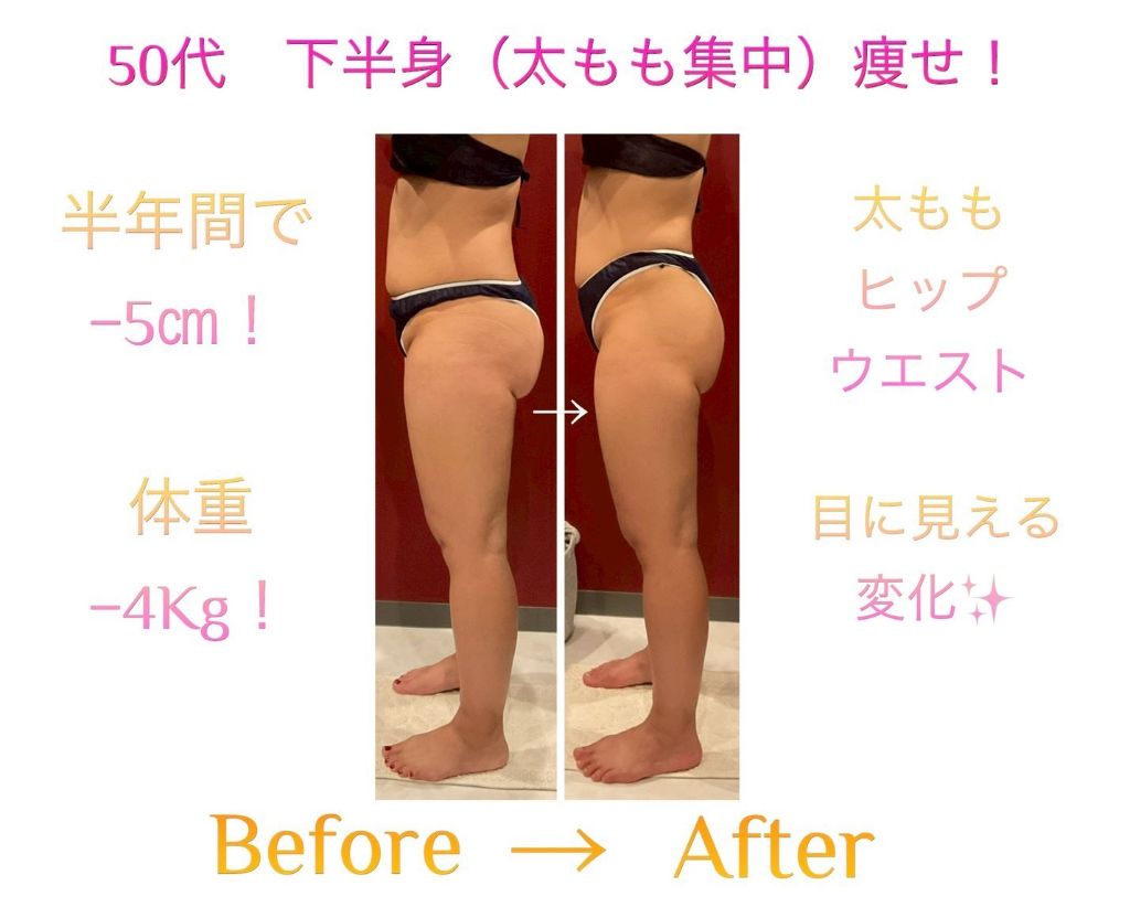 50代 下半身（太もも集中）痩せ ビフォーアフター