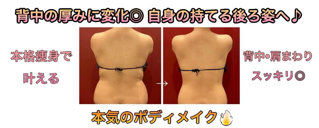 背中の厚みに変化 ビフォーアフター
