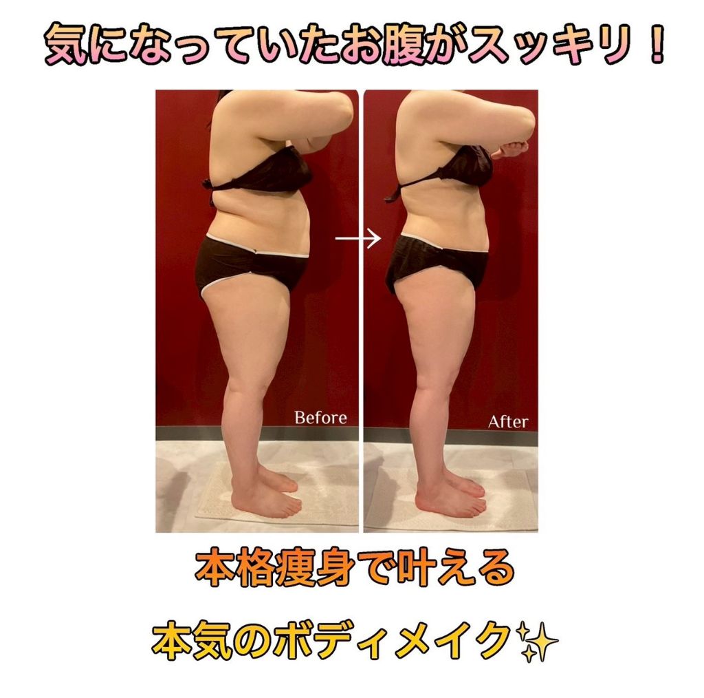 気になっていたお腹がスッキリ ビフォーアフター